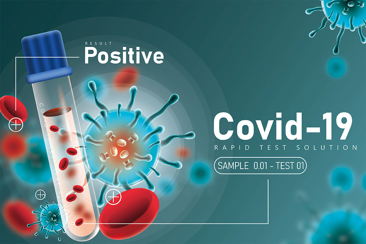 Tentang pengujian SARS-CoV-2 (COVID-19)